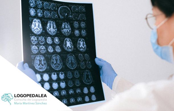 Día del Cerebro